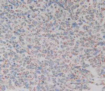 Immunohistochemistry (Formalin/PFA-fixed paraffin-embedded sections) - Anti-GC1q R antibody (AB232712), expandable thumbnail