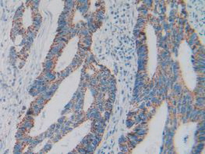 Immunohistochemistry (Formalin/PFA-fixed paraffin-embedded sections) - Anti-GC1q R antibody (AB232712), expandable thumbnail