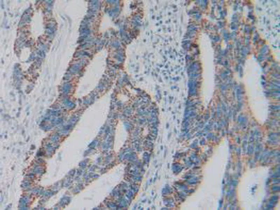 Immunohistochemistry (Formalin/PFA-fixed paraffin-embedded sections) - Anti-GC1q R antibody (AB232712)
