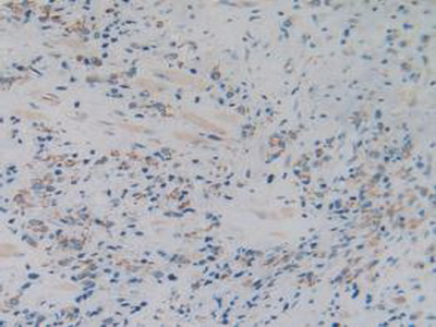Immunohistochemistry (Formalin/PFA-fixed paraffin-embedded sections) - Anti-GC1q R antibody (AB232712), expandable thumbnail