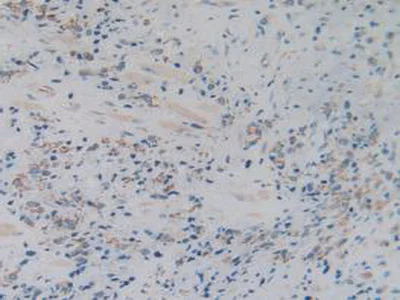Immunohistochemistry (Formalin/PFA-fixed paraffin-embedded sections) - Anti-GC1q R antibody (AB232712)