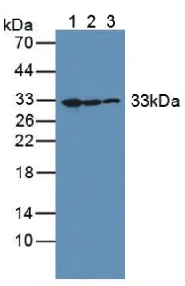 Western blot - Anti-GC1q R antibody (AB232712)