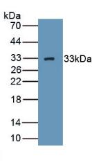 Western blot - Anti-GC1q R antibody (AB232712), expandable thumbnail