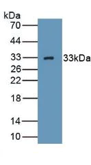 Western blot - Anti-GC1q R antibody (AB232712)