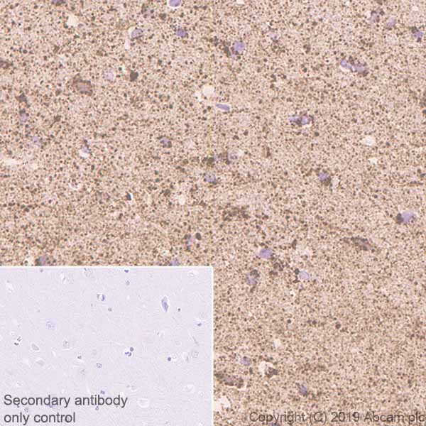 Immunohistochemistry (Formalin/PFA-fixed paraffin-embedded sections) - Anti-GC1q R antibody [EPR23238-107] - BSA and Azide free (AB270038), expandable thumbnail
