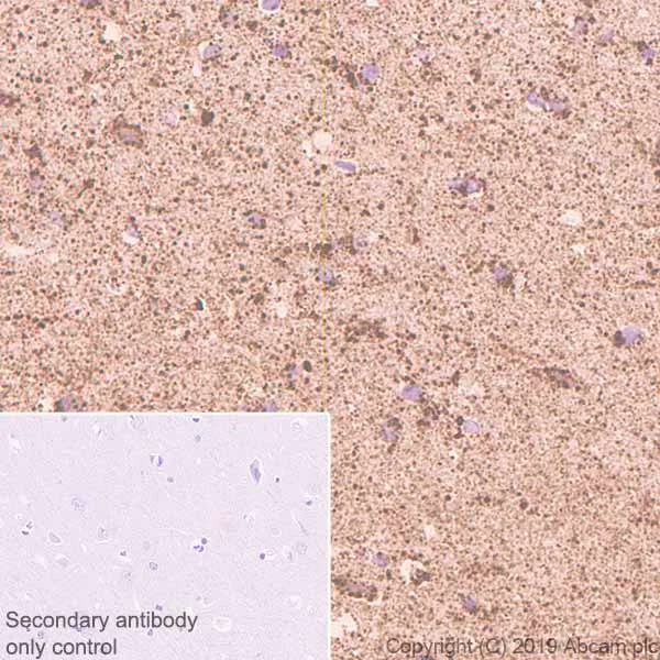 Immunohistochemistry (Formalin/PFA-fixed paraffin-embedded sections) - Anti-GC1q R antibody [EPR23238-107] - BSA and Azide free (AB270038)