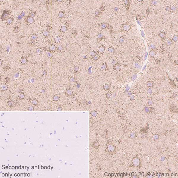 Immunohistochemistry (Formalin/PFA-fixed paraffin-embedded sections) - Anti-GC1q R antibody [EPR23238-107] - BSA and Azide free (AB270038), expandable thumbnail