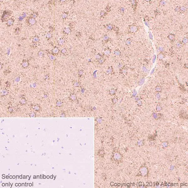 Immunohistochemistry (Formalin/PFA-fixed paraffin-embedded sections) - Anti-GC1q R antibody [EPR23238-107] - BSA and Azide free (AB270038)