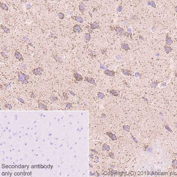 Immunohistochemistry (Formalin/PFA-fixed paraffin-embedded sections) - Anti-GC1q R antibody [EPR23238-107] - BSA and Azide free (AB270038), expandable thumbnail