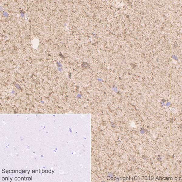 Immunohistochemistry (Formalin/PFA-fixed paraffin-embedded sections) - Anti-GC1q R antibody [EPR23238-6] - BSA and Azide free (AB270039), expandable thumbnail