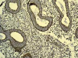 Immunohistochemistry (Formalin/PFA-fixed paraffin-embedded sections) - Anti-GC1q R antibody [EPR8870] (AB134926)