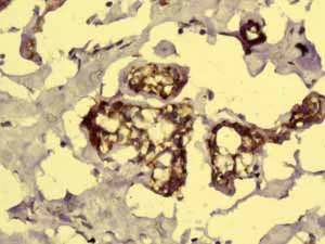 Immunohistochemistry (Formalin/PFA-fixed paraffin-embedded sections) - Anti-GC1q R antibody [EPR8870] (AB134926)