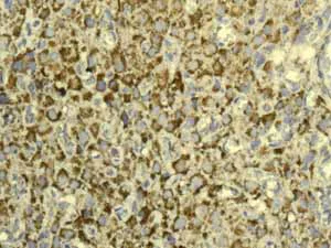 Immunohistochemistry (Formalin/PFA-fixed paraffin-embedded sections) - Anti-GC1q R antibody [EPR8870] (AB134926)