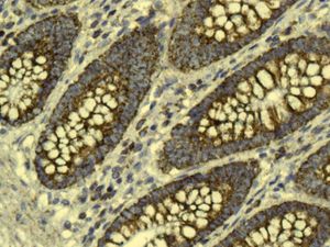 Immunohistochemistry (Formalin/PFA-fixed paraffin-embedded sections) - Anti-GC1q R antibody [EPR8870] (AB134926)