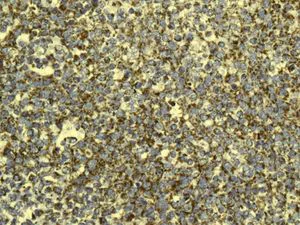 Immunohistochemistry (Formalin/PFA-fixed paraffin-embedded sections) - Anti-GC1q R antibody [EPR8870] (AB134926)