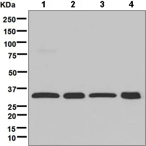 Western blot - Anti-GC1q R antibody [EPR8870] (AB134926)