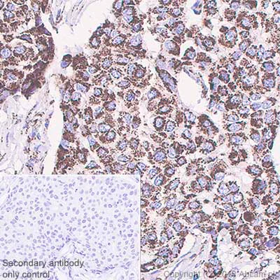 Immunohistochemistry (Formalin/PFA-fixed paraffin-embedded sections) - Anti-GC1q R antibody [EPR8871] (AB131284)