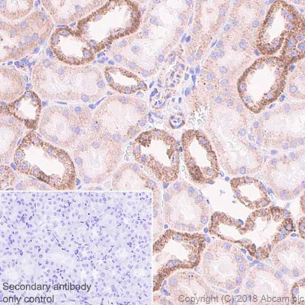 Immunohistochemistry (Formalin/PFA-fixed paraffin-embedded sections) - Anti-GC1q R antibody [EPR8871] (AB131284)