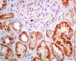 Immunohistochemistry (Formalin/PFA-fixed paraffin-embedded sections) - Anti-GC1q R antibody [EPR8871] - BSA and Azide free (AB238965), expandable thumbnail
