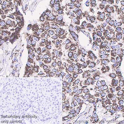 Immunohistochemistry (Formalin/PFA-fixed paraffin-embedded sections) - Anti-GC1q R antibody [EPR8871] - BSA and Azide free (AB238965), expandable thumbnail