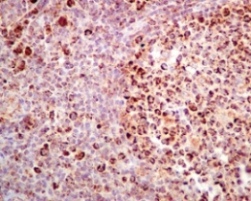 Immunohistochemistry (Formalin/PFA-fixed paraffin-embedded sections) - Anti-GC1q R antibody [EPR8871] - BSA and Azide free (AB238965), expandable thumbnail