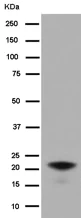 Western blot - Anti-GCAP2 antibody [EPR14571] (AB184958)