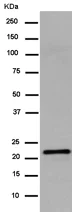 Western blot - Anti-GCAP2 antibody [EPR14571] - BSA and Azide free (AB250794)