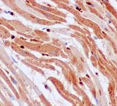 Immunohistochemistry (Formalin/PFA-fixed paraffin-embedded sections) - Anti-GCAT antibody [EPR13450] - BSA and Azide free (AB250342)