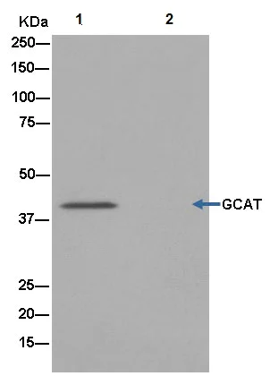 Immunoprecipitation - Anti-GCAT antibody [EPR13450] - BSA and Azide free (AB250342)