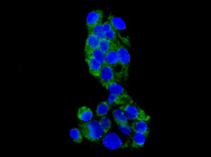 Immunocytochemistry/ Immunofluorescence - Anti-GCAT antibody [EPR13450] - N-terminal (AB181094)