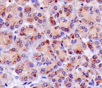 Immunohistochemistry (Formalin/PFA-fixed paraffin-embedded sections) - Anti-GCAT antibody [EPR13450] - N-terminal (AB181094), expandable thumbnail