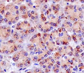 Immunohistochemistry (Formalin/PFA-fixed paraffin-embedded sections) - Anti-GCAT antibody [EPR13450] - N-terminal (AB181094)