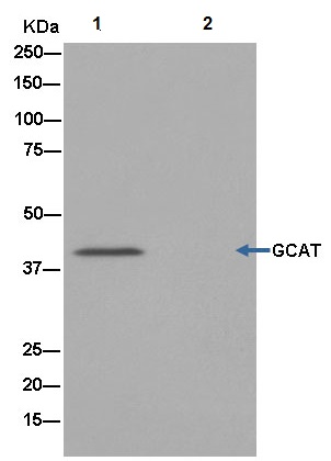 Immunoprecipitation - Anti-GCAT antibody [EPR13450] - N-terminal (AB181094), expandable thumbnail