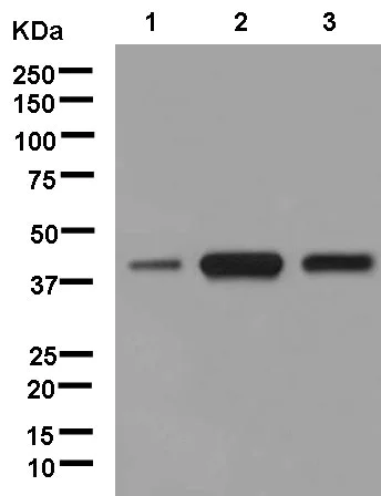 Western blot - Anti-GCAT antibody [EPR13450] - N-terminal (AB181094)