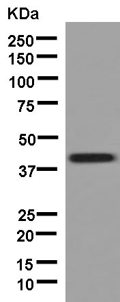 Western blot - Anti-GCAT antibody [EPR13450] - N-terminal (AB181094), expandable thumbnail