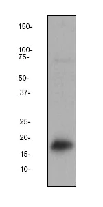 Western blot - Anti-GCDFP 15 antibody [EP1582Y] (AB62363)