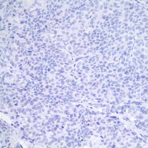 Immunohistochemistry (Formalin/PFA-fixed paraffin-embedded sections) - Anti-GCDFP 15 antibody [EP1582Y] - BSA and Azide free (AB235998), expandable thumbnail
