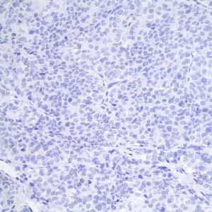 Immunohistochemistry (Formalin/PFA-fixed paraffin-embedded sections) - Anti-GCDFP 15 antibody [EP1582Y] - BSA and Azide free (AB235998)