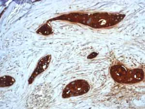 Immunohistochemistry (Formalin/PFA-fixed paraffin-embedded sections) - Anti-GCDFP 15 antibody [EP1582Y] - BSA and Azide free (AB235998)