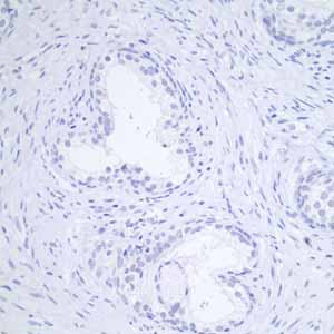 Immunohistochemistry (Formalin/PFA-fixed paraffin-embedded sections) - Anti-GCDFP 15 antibody [EP1582Y] - BSA and Azide free (ab235998), expandable thumbnail