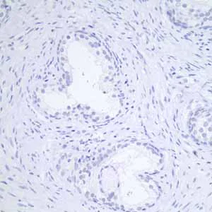 Immunohistochemistry (Formalin/PFA-fixed paraffin-embedded sections) - Anti-GCDFP 15 antibody [EP1582Y] - BSA and Azide free (AB235998)