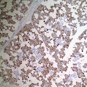 Immunohistochemistry (Formalin/PFA-fixed paraffin-embedded sections) - Anti-GCDFP 15 antibody [EP1582Y] - BSA and Azide free (AB235998), expandable thumbnail