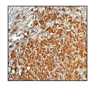 Immunohistochemistry (Formalin/PFA-fixed paraffin-embedded sections) - Anti-GCDFP 15 antibody [EP1582Y] - BSA and Azide free (AB235998)