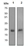 Western blot - Anti-GCDFP 15 antibody [EP1583(2)] (AB133271)
