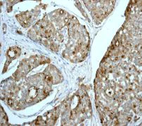 Immunohistochemistry (Formalin/PFA-fixed paraffin-embedded sections) - Anti-GCDFP 15 antibody [EPR1582] - BSA and Azide free (AB248449)