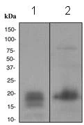 Western blot - Anti-GCDFP 15 antibody [EPR1582] - BSA and Azide free (AB248449)