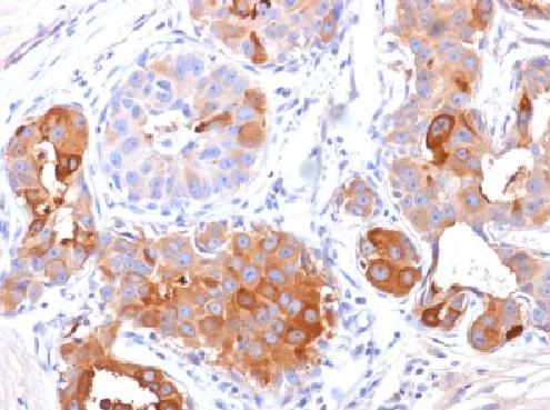 Immunohistochemistry (Formalin/PFA-fixed paraffin-embedded sections) - Anti-GCDFP 15 antibody [PIP/1571] (AB218480)