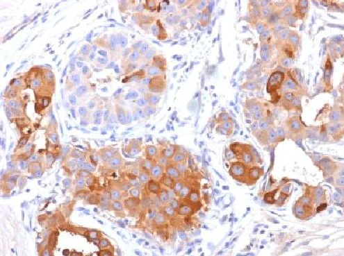 Immunohistochemistry (Formalin/PFA-fixed paraffin-embedded sections) - Anti-GCDFP 15 antibody [PIP/1571] (AB218480)