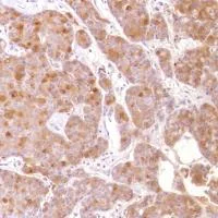 Immunohistochemistry (Formalin/PFA-fixed paraffin-embedded sections) - Anti-GCDFP 15 antibody [SP185] - BSA and Azide free (AB238776)