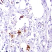 Immunohistochemistry (Formalin/PFA-fixed paraffin-embedded sections) - Anti-GCDFP 15 antibody [SP185] - BSA and Azide free (AB238776)